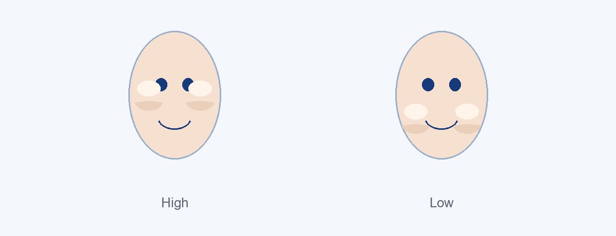 Diagram comparing high cheekbones and low cheekbones on the same face