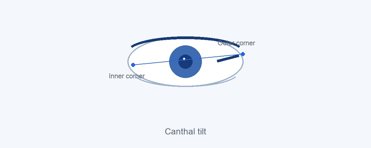 Diagram of canthal tilt measured from inner to outer eye corner