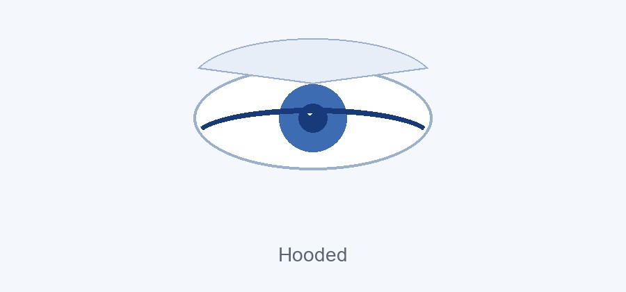 Hooded eye shape with the crease covered by the upper lid