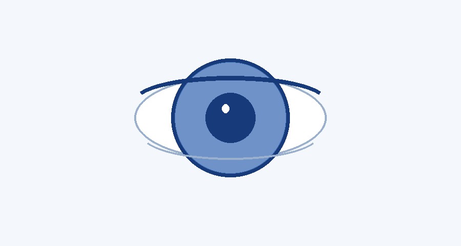 Close-up of an eye with a dark limbal ring around the iris